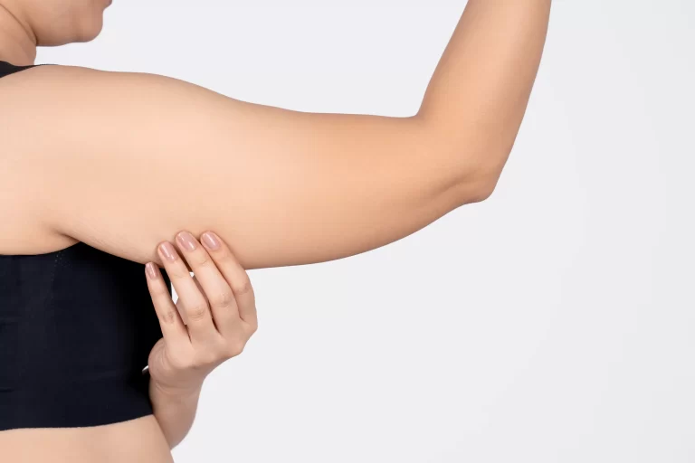 Is Arm Liposuction Worth It? Exploring The Benefits