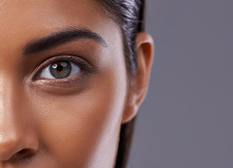Can Fillers Remove Dark Circles? A Comprehensive Guide