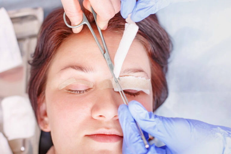 Eyelid Surgery And Blood Thinners