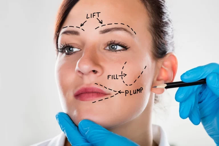 Facelift Surgery: What Is It And How Can It Rejuvenate Your Appearance?