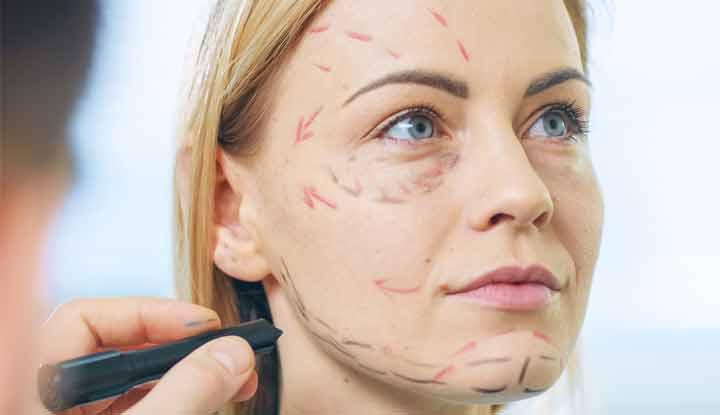 Facelift Surgery Duration