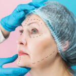 Most Expensive Plastic Surgery Informative