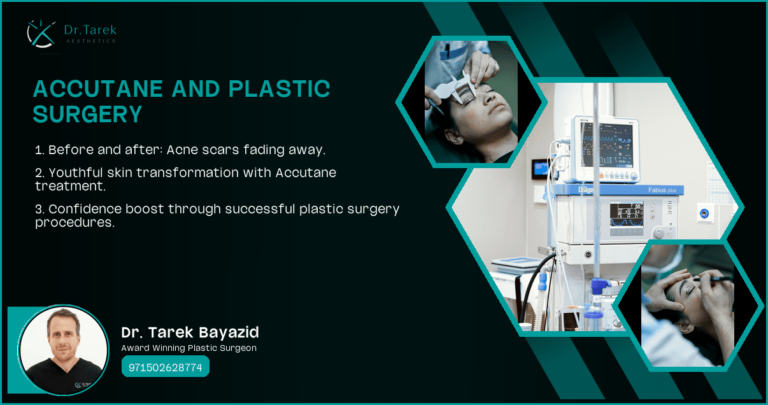Accutane-And-Plastic-Surgery