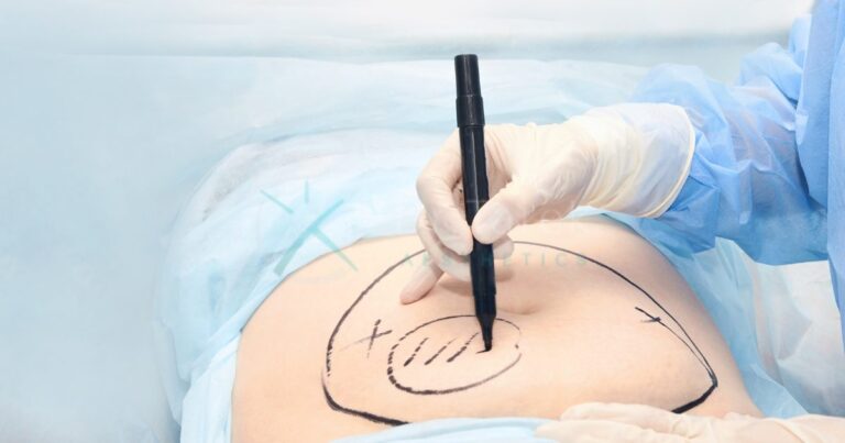 Airsculpt-Liposuction-All-You-Need-To-Know