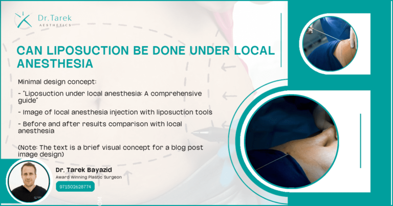 Can-Liposuction-Be-Done-Under-Local-Anesthesia