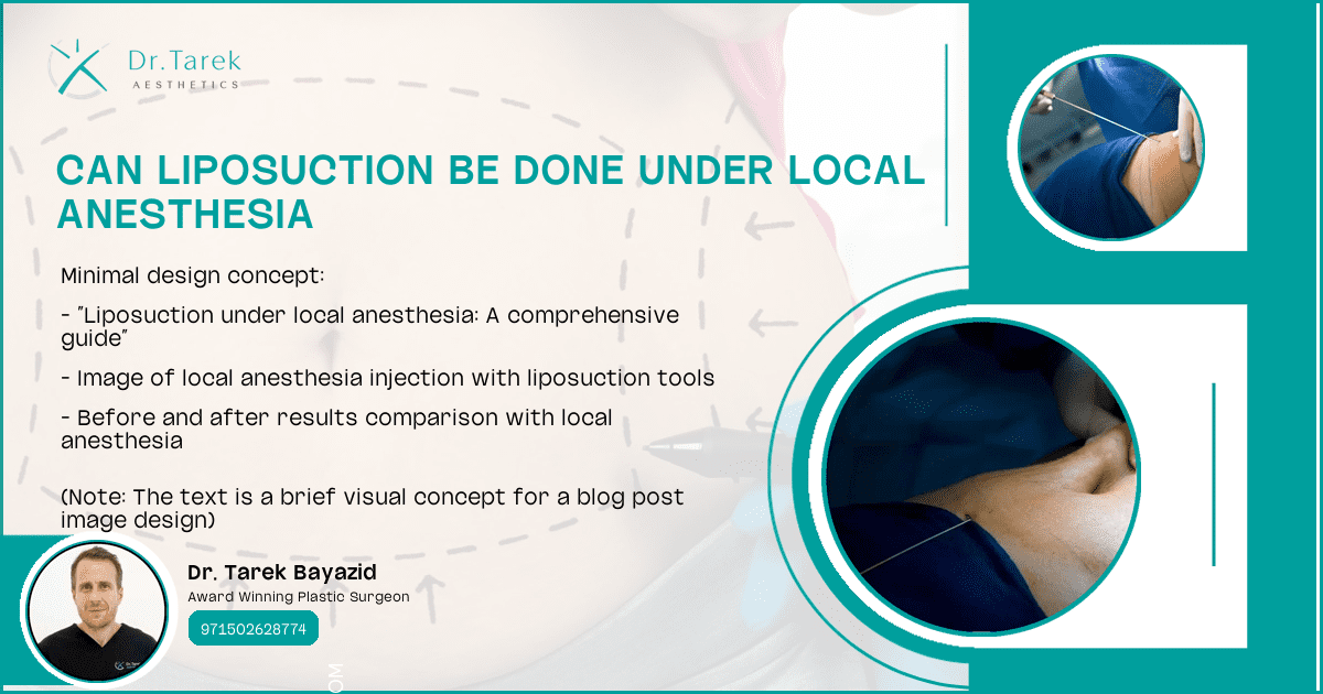 Can-Liposuction-Be-Done-Under-Local-Anesthesia