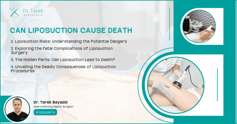 Can-Liposuction-Cause-Death