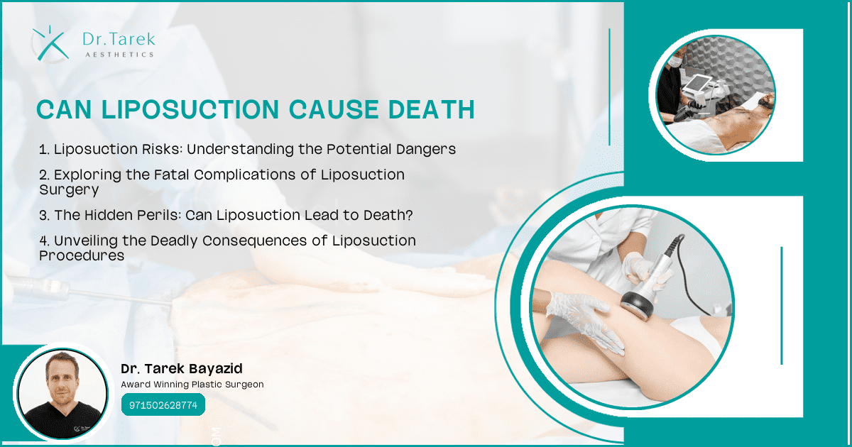 Can-Liposuction-Cause-Death