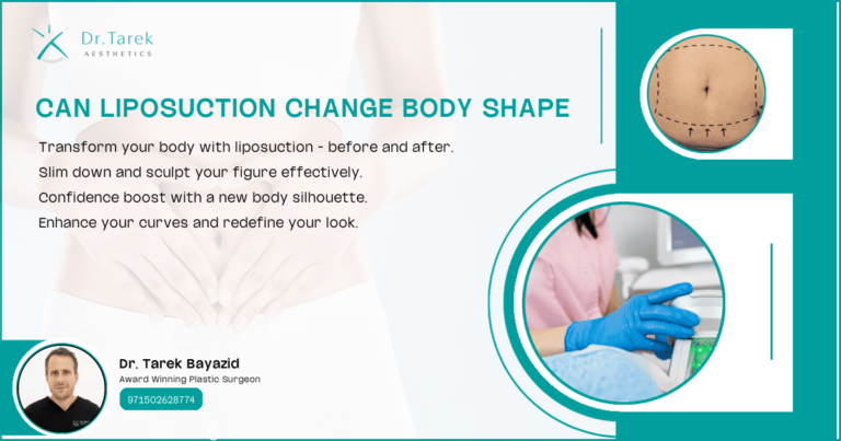 Can-Liposuction-Change-Body-Shape