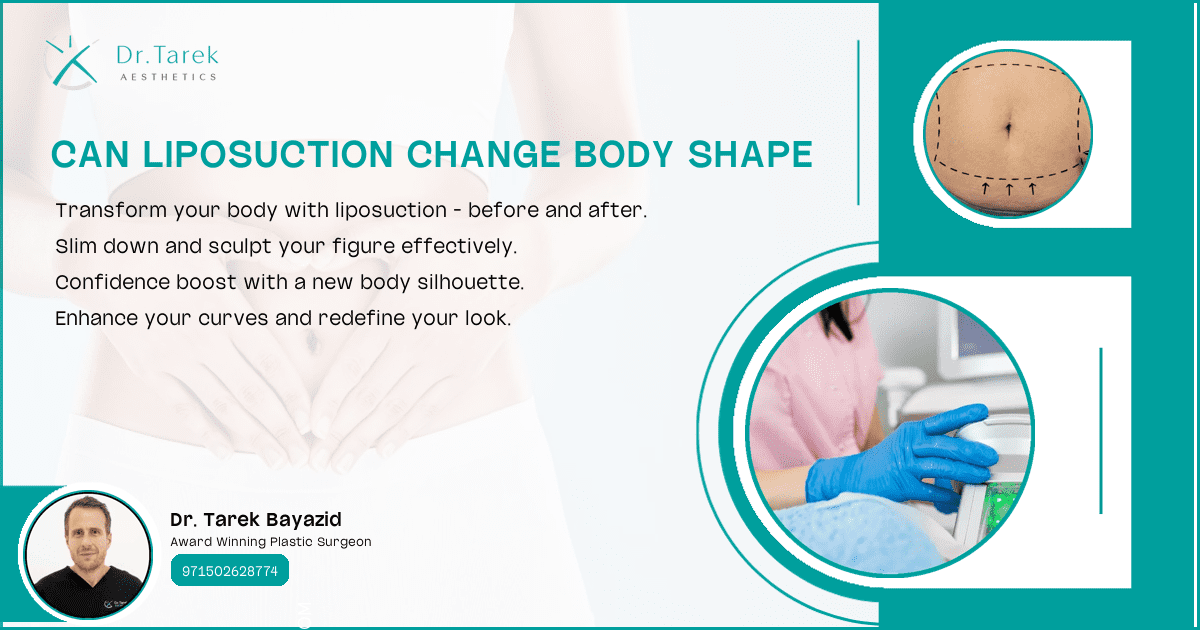 Can-Liposuction-Change-Body-Shape