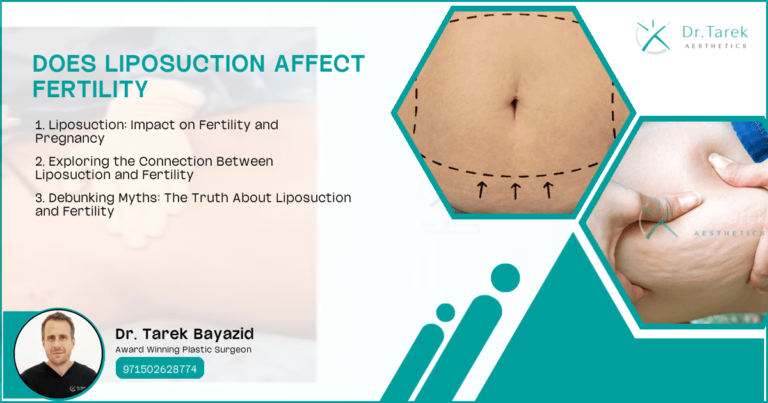 Does-Liposuction-Affect-Fertility