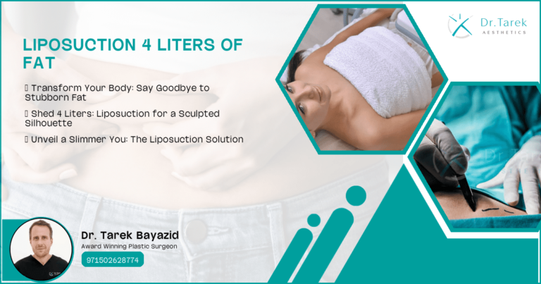 Liposuction-4-Liters-Of-Fat