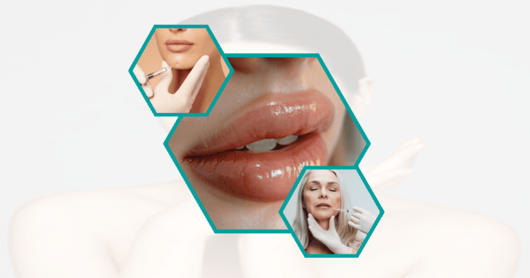 10-Essential-Aftercare-Tips-For-Lip-Fillers