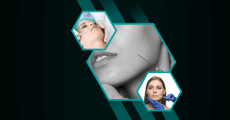 Can-Botox-Be-Used-Around-The-Mouth