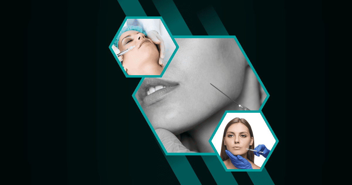 Can-Botox-Be-Used-Around-The-Mouth