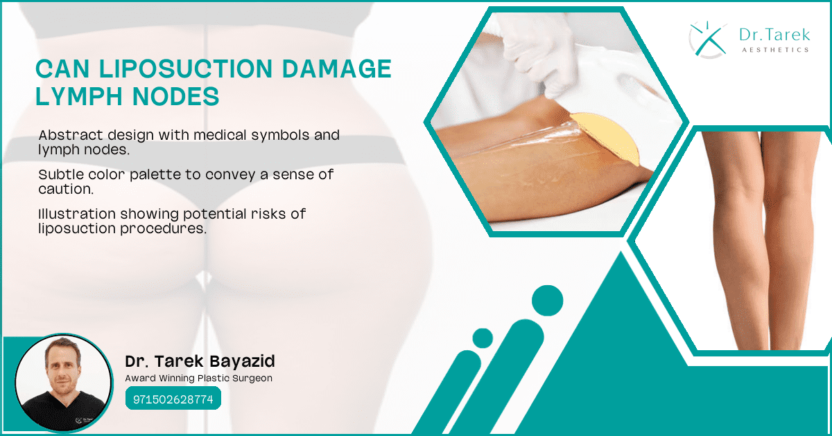 Can-Liposuction-Damage-Lymph-Nodes