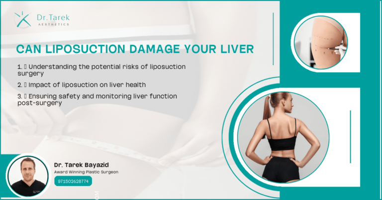 Can-Liposuction-Damage-Your-Liver