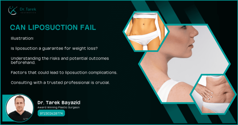 Can-Liposuction-Fail