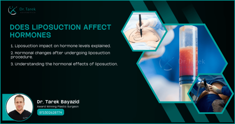 Does-Liposuction-Affect-Hormones