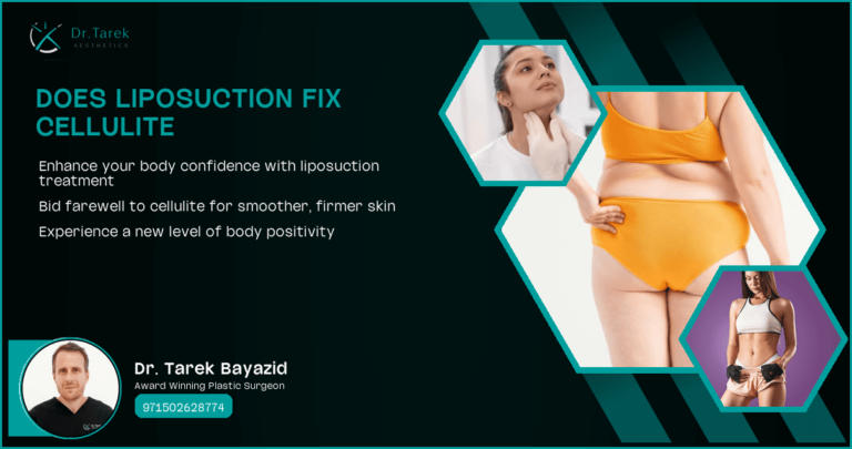 Does-Liposuction-Fix-Cellulite