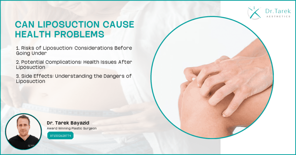 Can Liposuction Cause Health Problems 2026