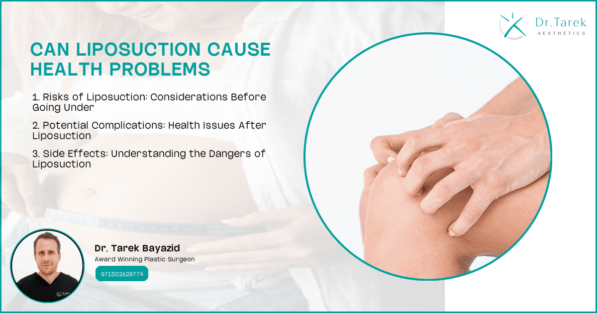 Can-Liposuction-Cause-Health-Problems