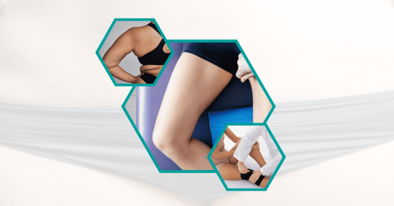 Can-Liposuction-Help-Diastasis-Recti