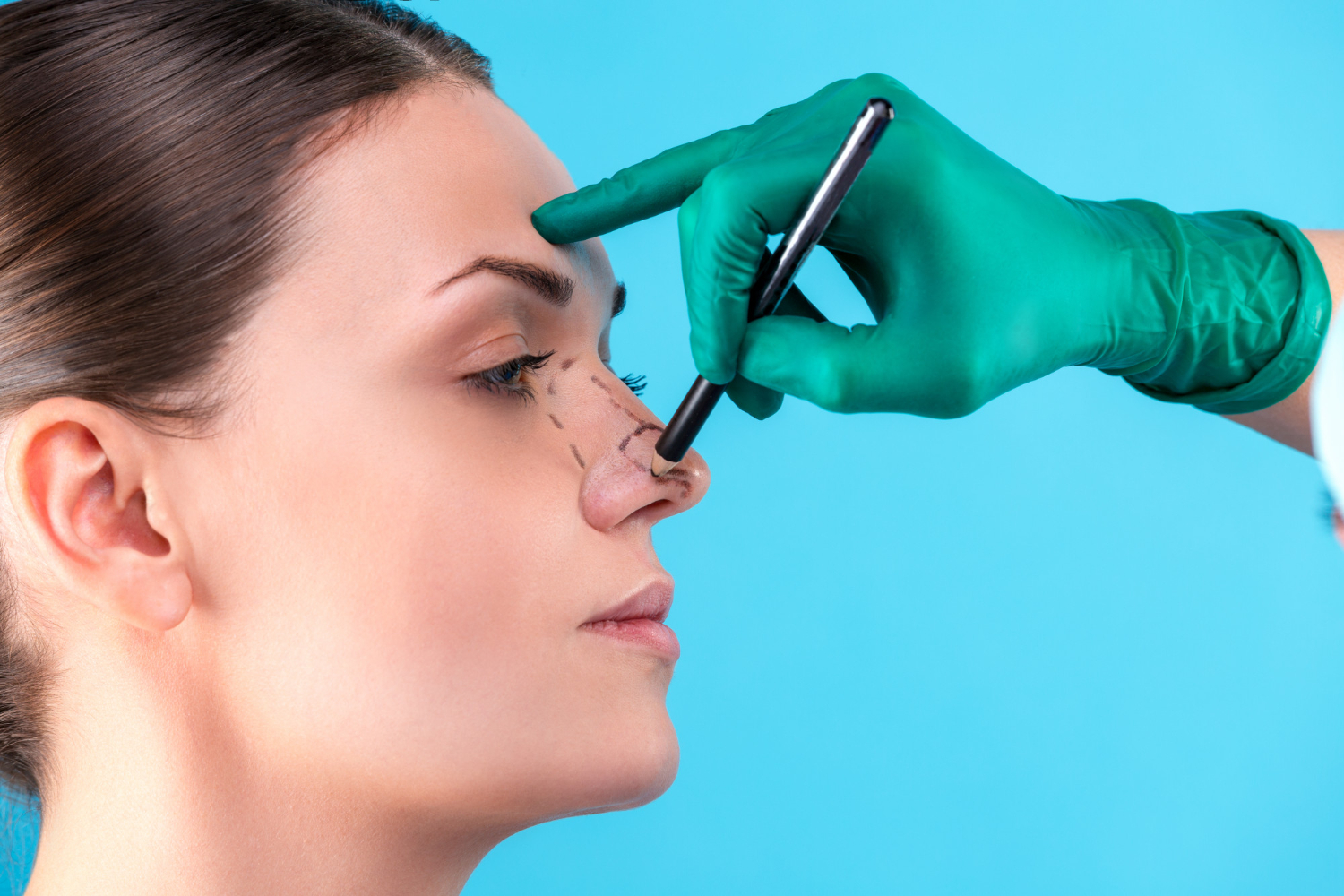 Rhinoplasty In Dubai Complete Recovery Guide And What To Expect