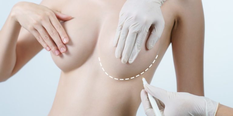 What Is Recovery Like After Breast Augmentation Dubai