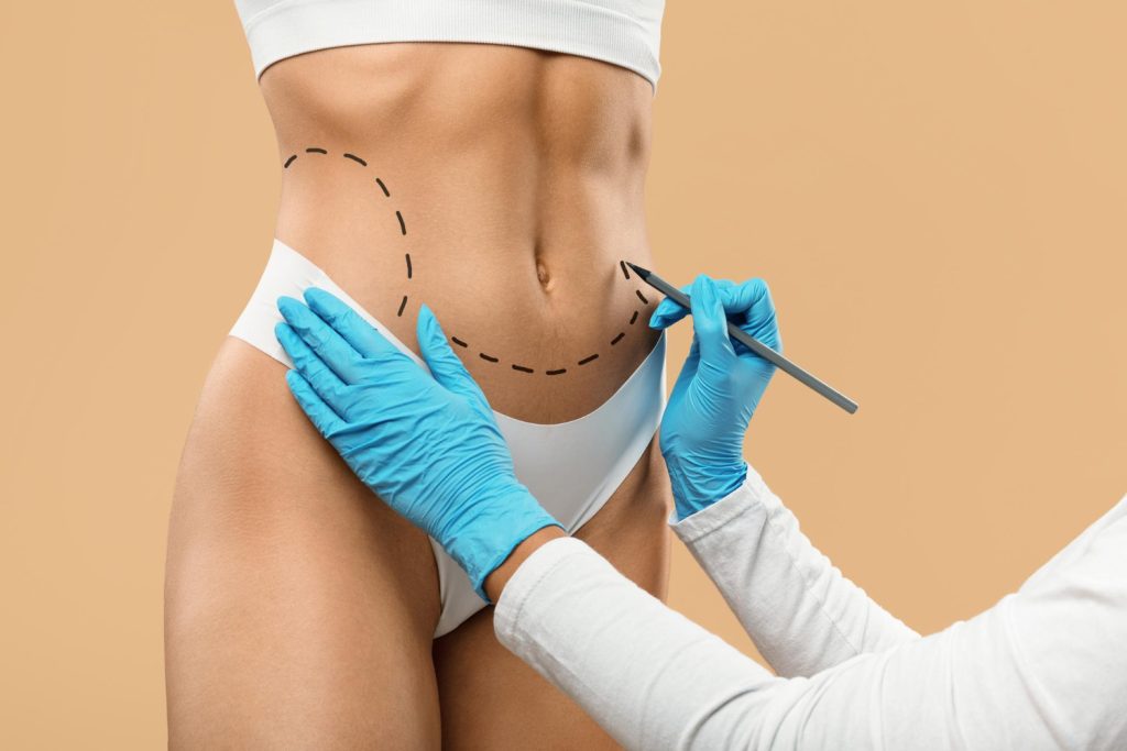 Liposuction In Dubai The Complete Guide To Body Contouring