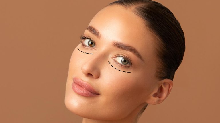 How To Prepare For Eyelid Surgery