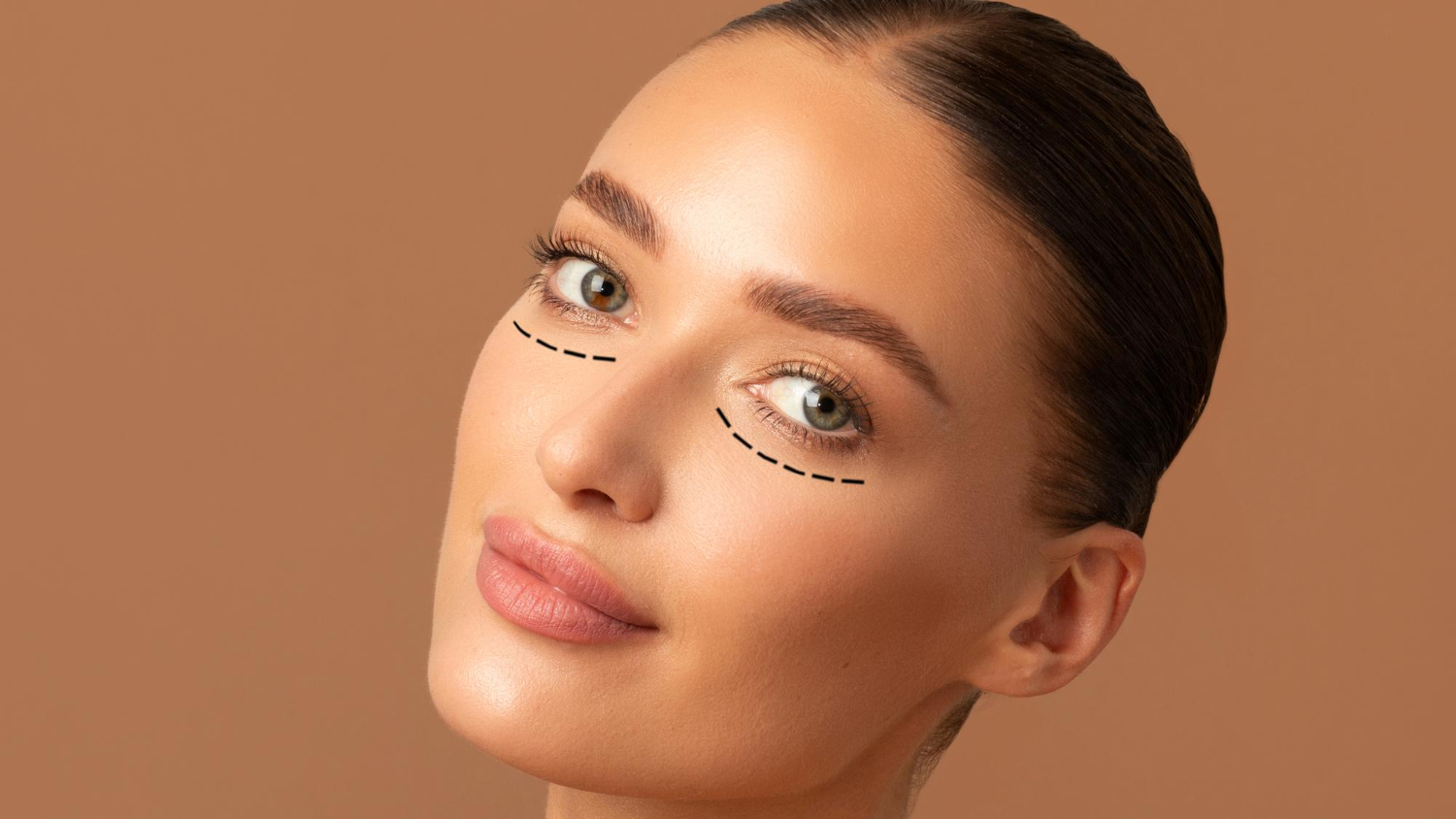 How To Prepare For Eyelid Surgery